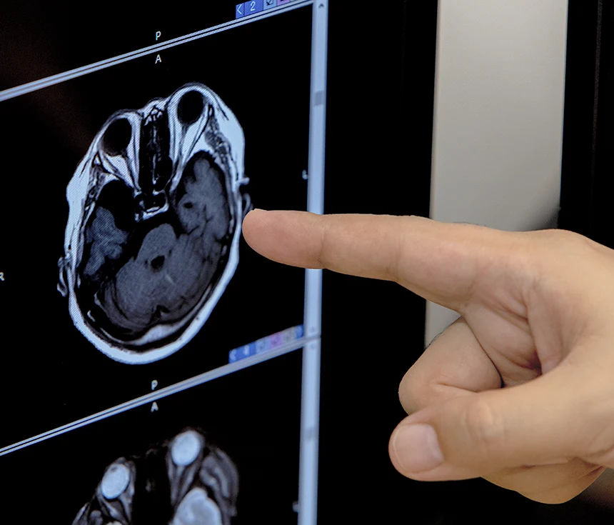 AI搭載MRIで検査時間を短縮